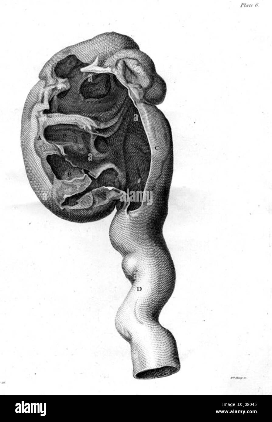 Hunter Widget Kidney fait référence à une illustration médicale de John Hunter, montrant l'anatomie du rein dans un état élargi à des fins éducatives. Banque D'Images