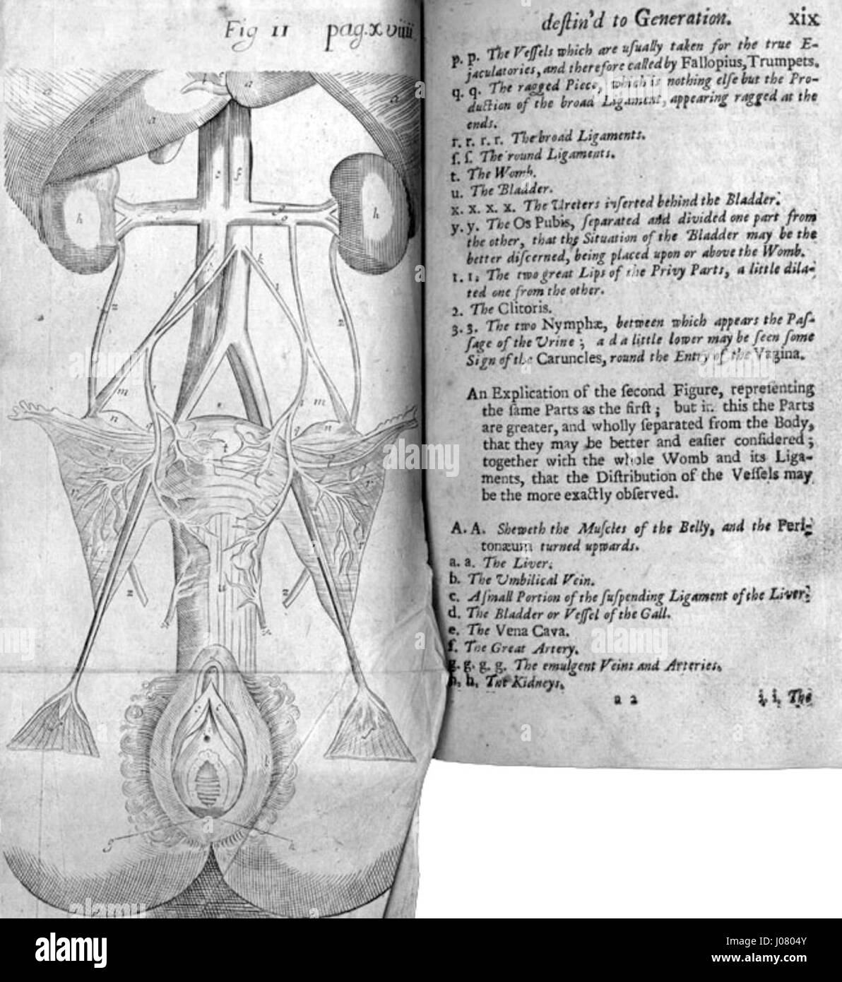 Le dessin schématique d’une femme de Mauriceau est une illustration médicale du XVIIIe siècle, présentant des caractéristiques anatomiques et physiologiques détaillées du corps féminin, importantes dans l’étude de l’obstétrique et de la gynécologie. Banque D'Images