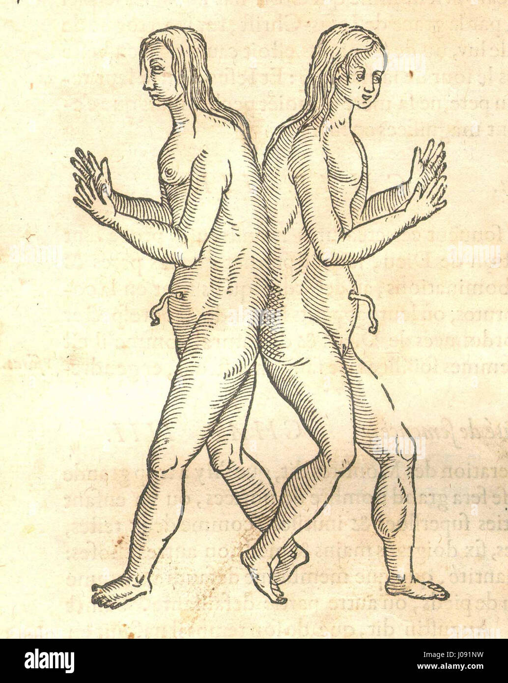 Ambroise Paré, un chirurgien français pionnier, a documenté des jumeaux conjoints dans cette illustration médicale du XVIe siècle. Le travail de Paré reflète ses contributions importantes à la médecine moderne précoce et ses efforts pour faire progresser les techniques chirurgicales. Banque D'Images