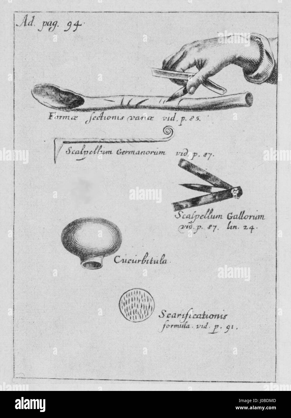 Botallo Aderlassgeräte, ou dispositifs de saignée, sont des instruments médicaux historiquement utilisés dans la pratique de saignée, une procédure médicale courante dans les siècles précédents. Cette représentation saisit le savoir-faire artisanal et la signification historique de ces outils médicaux. Banque D'Images