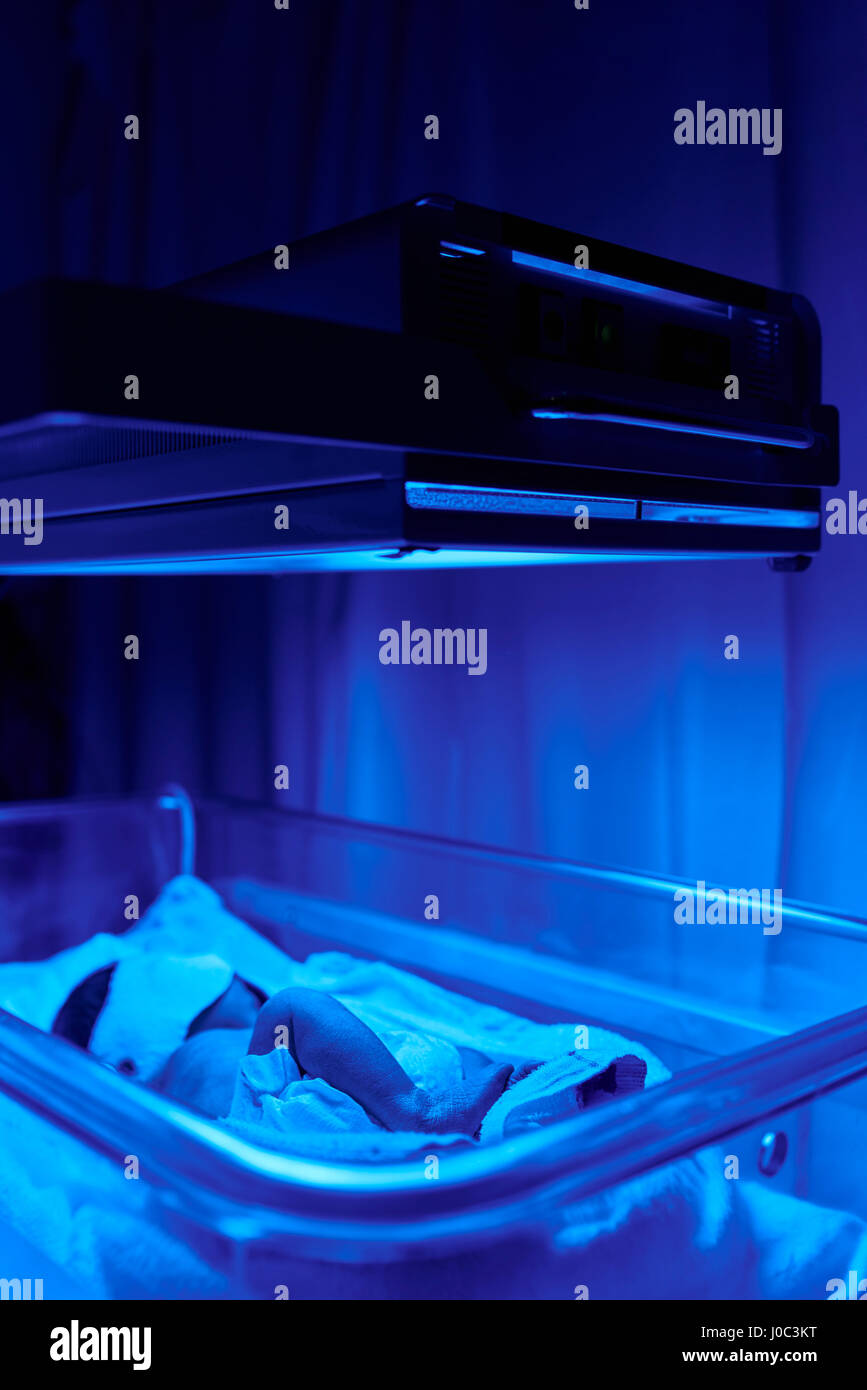 Le traitement par la lumière bleue pour bébé avec jaunisse Photo Stock -  Alamy