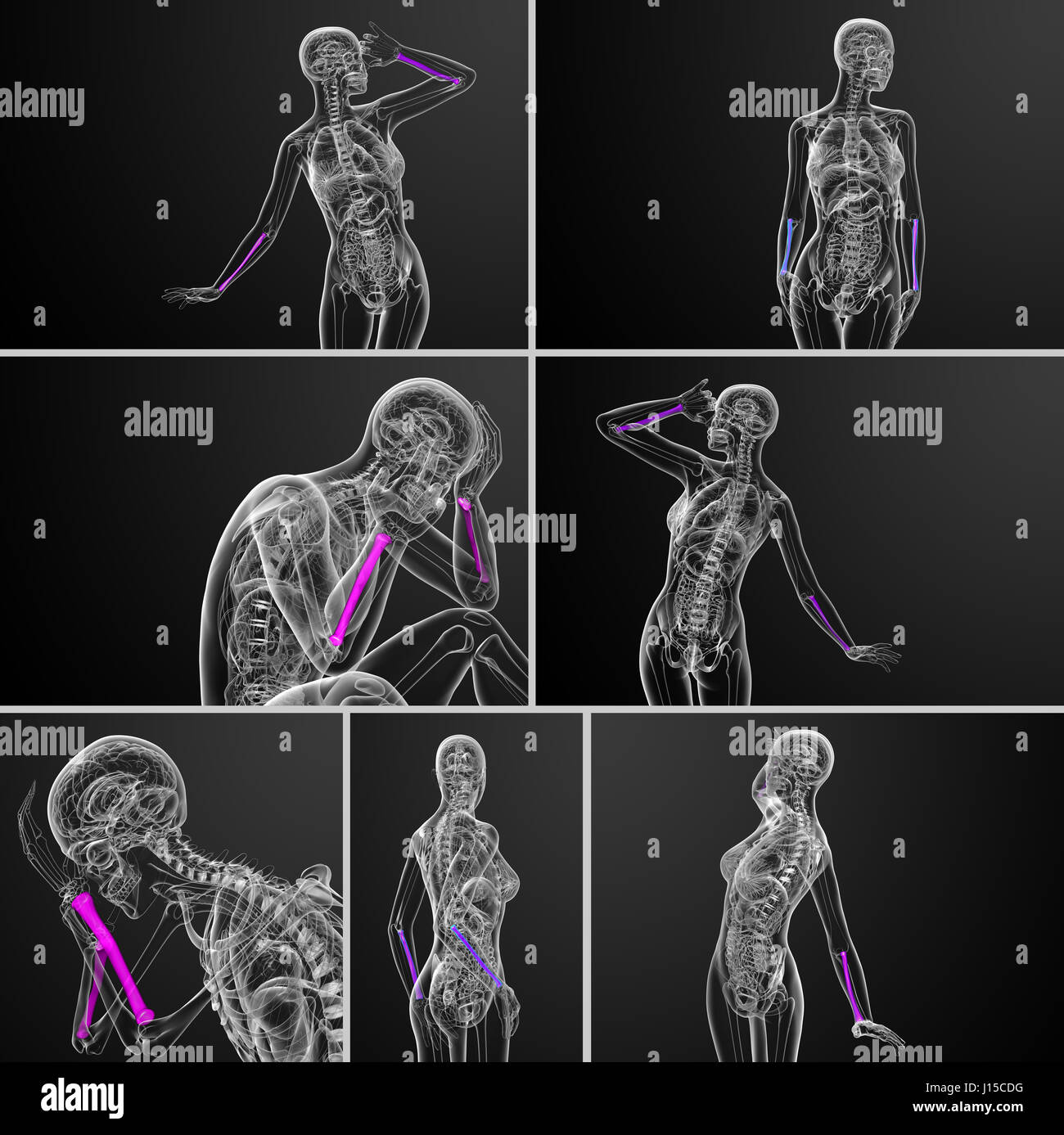Le rendu 3d illustration médicale de l'os radius Banque D'Images