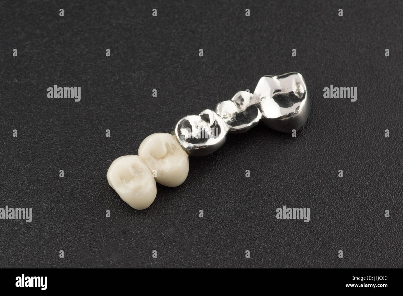 Comblé pour les prothèses dentaires sont en acier et céramique coller Banque D'Images