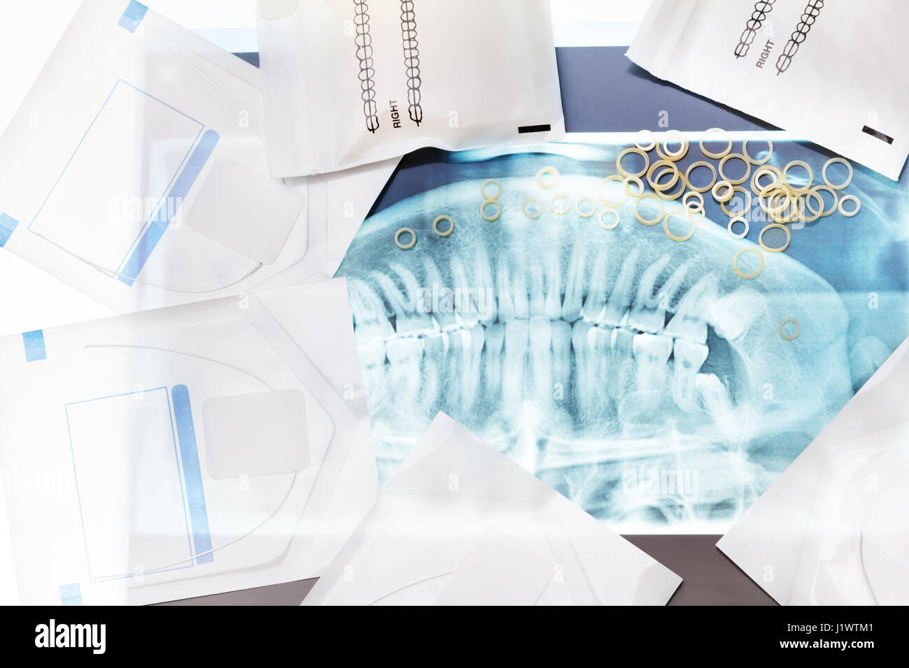 De nombreux outils pour les soins dentaires, y compris les accolades et les colliers bagues latex jeter sur xray jaw Banque D'Images
