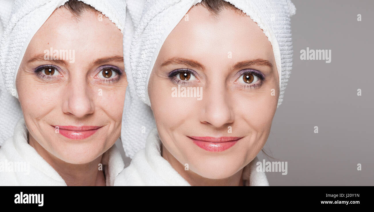 Femme heureuse après traitement de beauté - photos avant/après - soins de la peau, anti-vieillissement, rajeunissement des procédures, le levage, le serrage de la peau du visage Banque D'Images