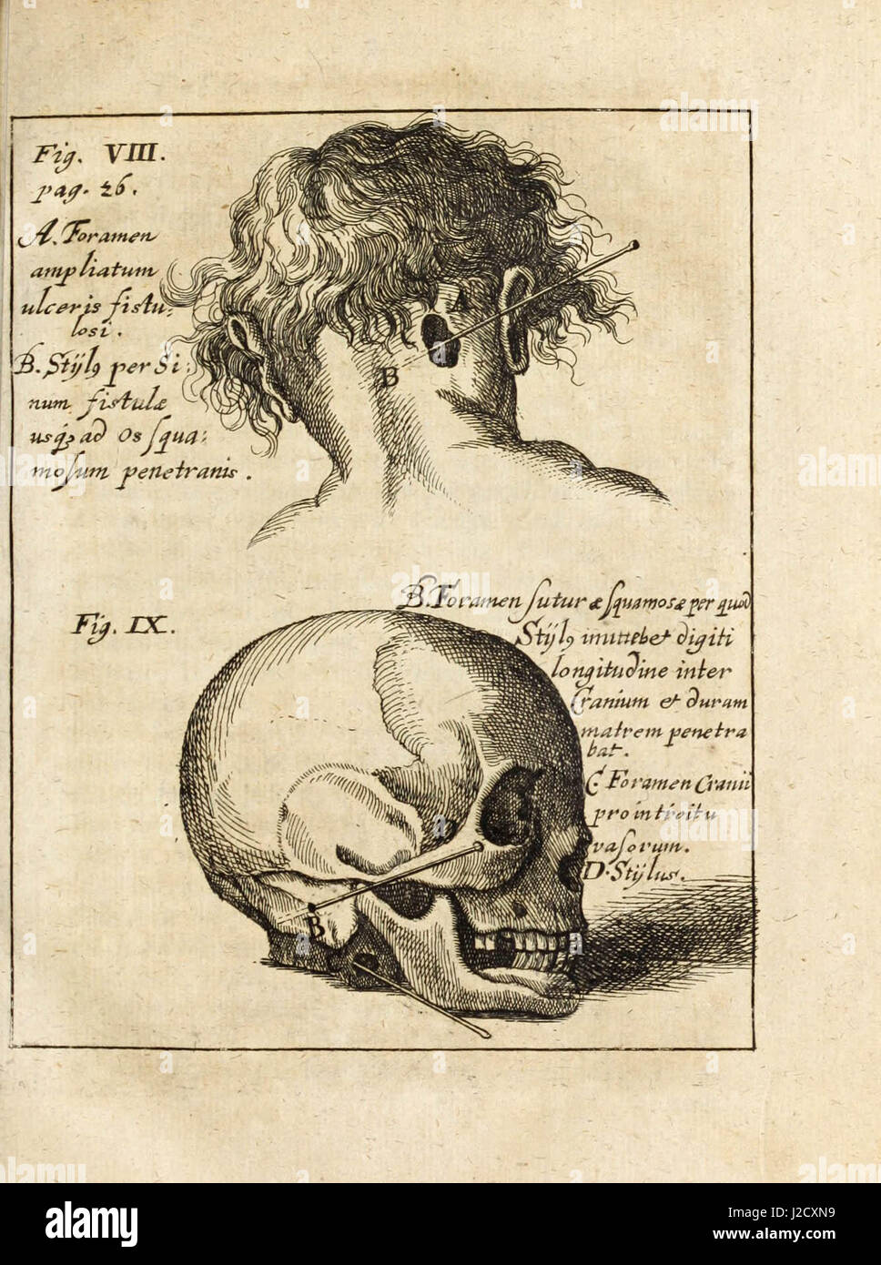 «Iscellanea système érotiques, sive, Ephemeridum Germanicarum médico-physicarum' (1700) Banque D'Images