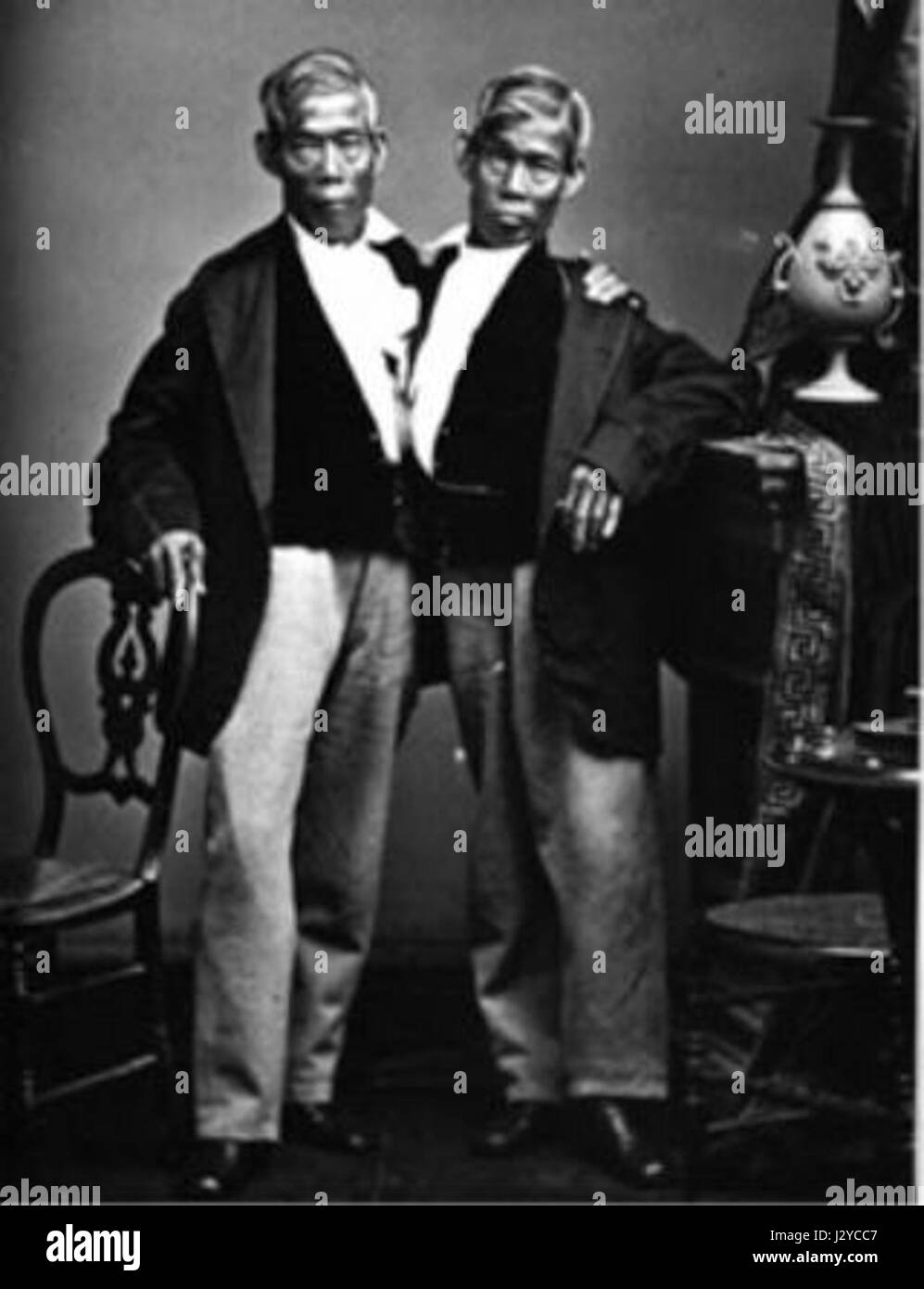 Chang et Eng étaient des jumeaux conjoints de Thaïlande, célèbres pour leur condition physique unique. Leurs vies ont été marquées par des expositions publiques, car ils sont devenus l'un des couples jumeaux conjoints les plus célèbres de l'histoire, contribuant aux discussions médicales et sociales sur leur état. Banque D'Images
