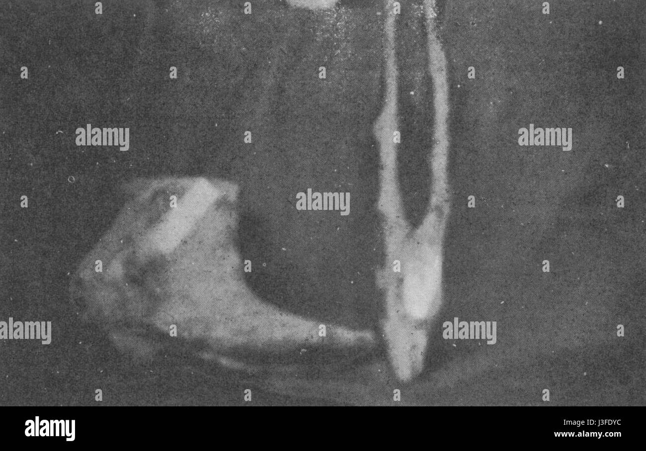 Photographie d'un pied Fluviana, faisant éventuellement référence à un spécimen anatomique spécifique, à côté de la tête d'une gazelle, mettant en évidence l'anatomie comparée. Banque D'Images