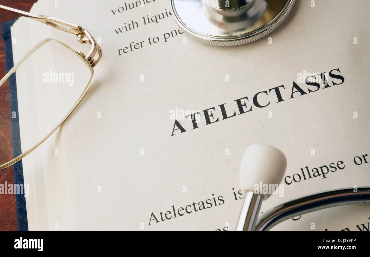 Document avec atélectasie diagnostic dans un hôpital. Banque D'Images