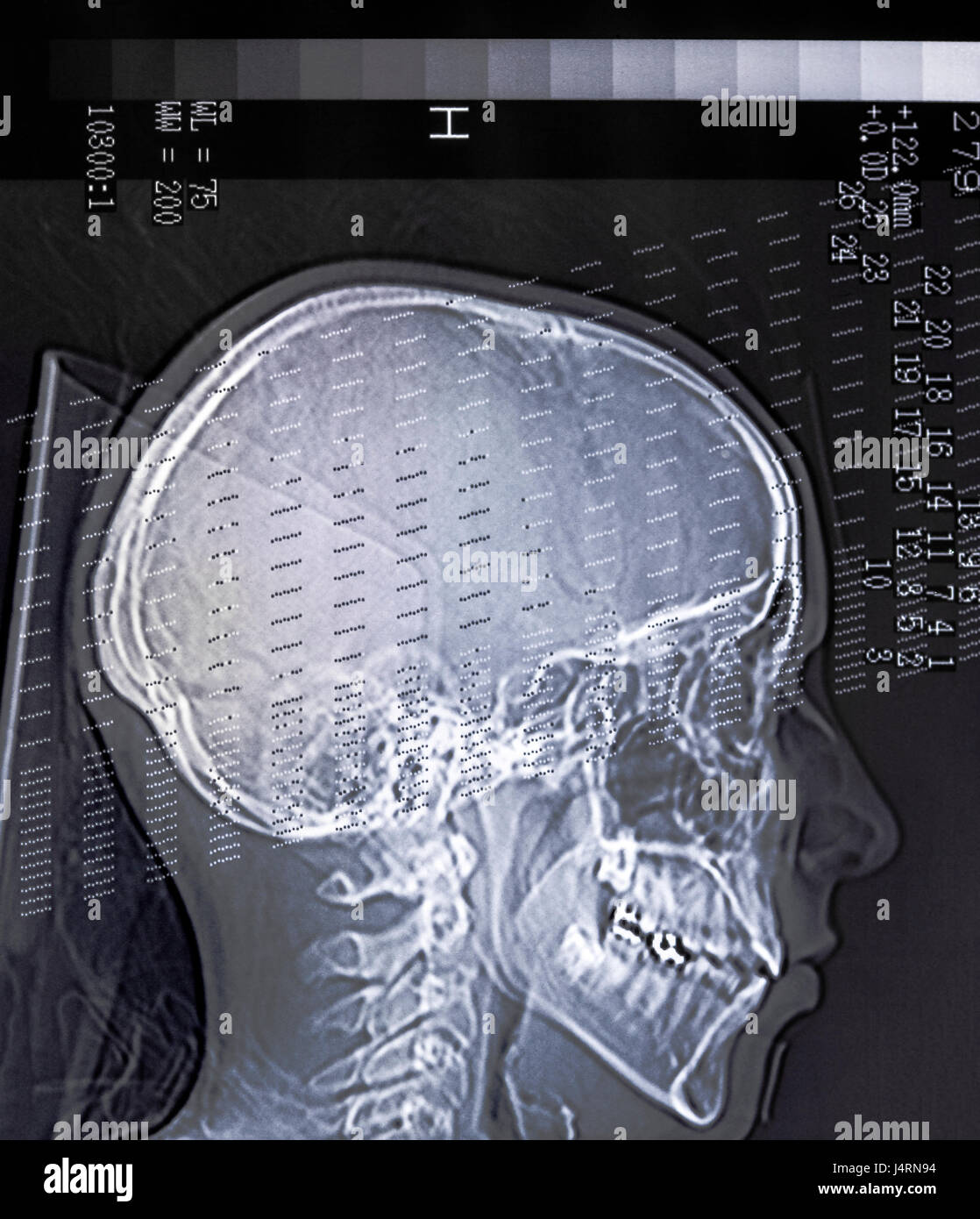 Xray scanner de la tête d'une personne avec quelques données Photo — free download