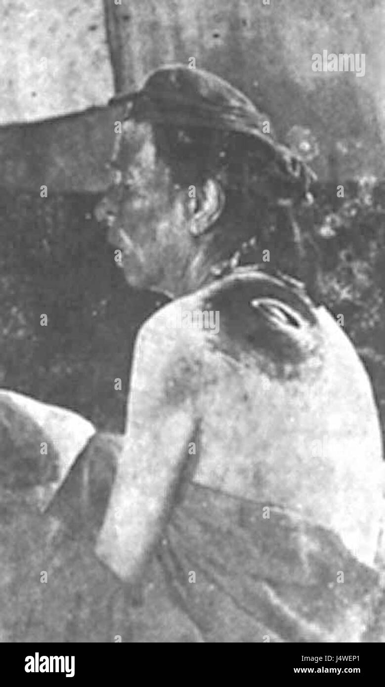 Une photographie représentant une femme turque avec une blessure visible à la baïonnette, reflétant les épreuves et les souffrances pendant un conflit. L'image met en évidence le coût humain de la guerre et son impact sur les civils. Banque D'Images