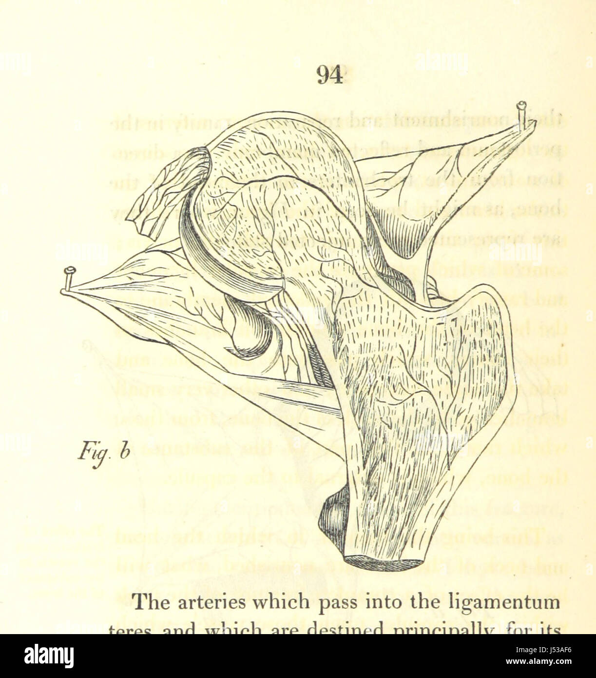 Image prise à partir de la page 112 de "remarques pratiques sur la nature et le traitement des fractures du tronc et des extrémités, etc' Banque D'Images