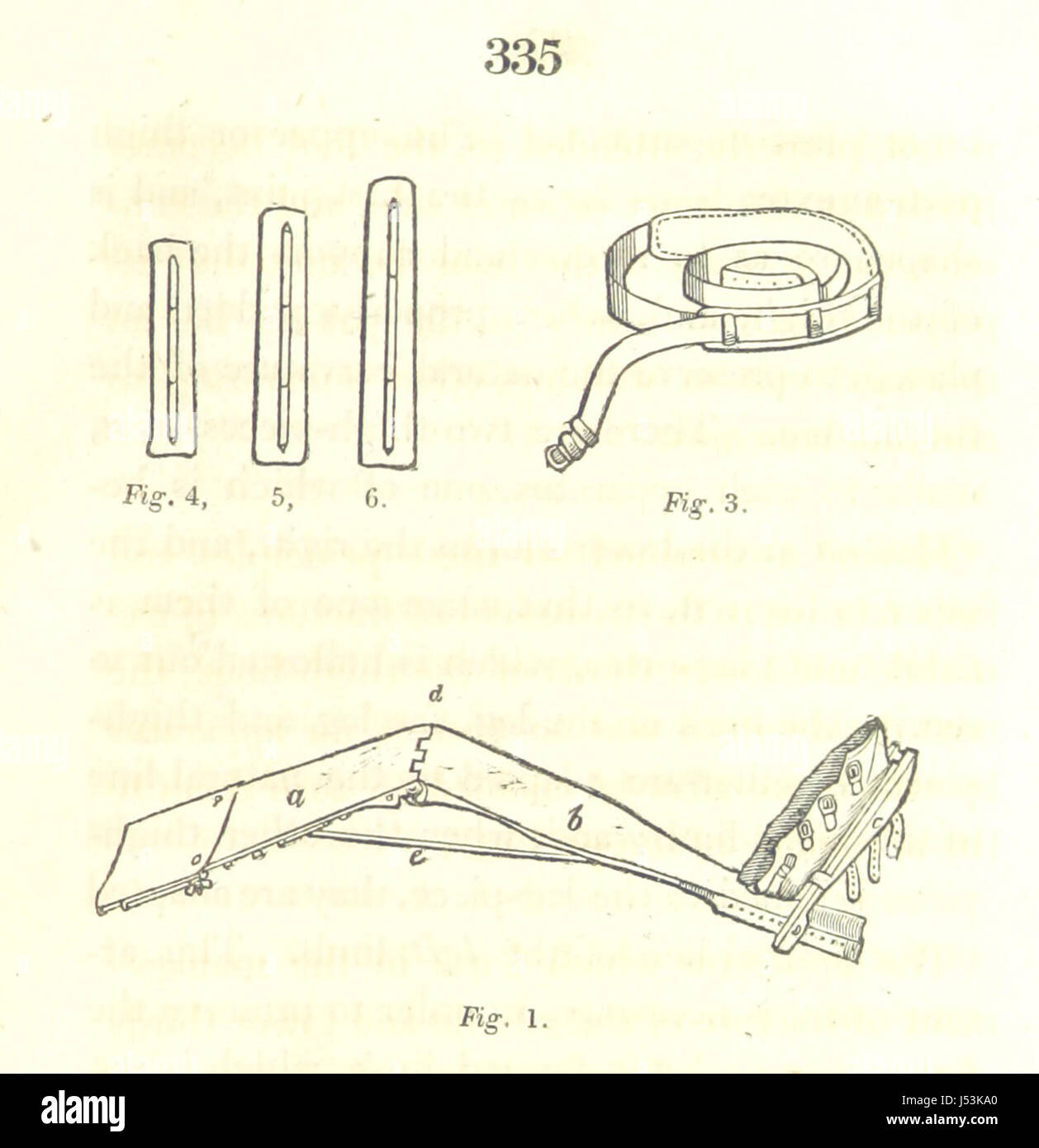 Ce texte traite de la prise en charge médicale des fractures affectant le tronc et les extrémités. Il fournit un aperçu pratique des méthodes de diagnostic et de traitement dans une perspective historique de la médecine. Banque D'Images