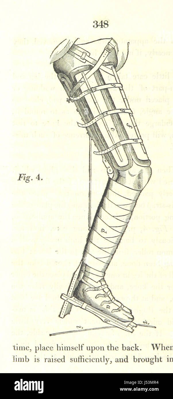 Ce travail traite du traitement médical des fractures du tronc et des extrémités, offrant des conseils pratiques sur le diagnostic, les soins et les méthodes de traitement. Le texte couvre différents types de fractures, leur prise en charge et les considérations chirurgicales. Banque D'Images