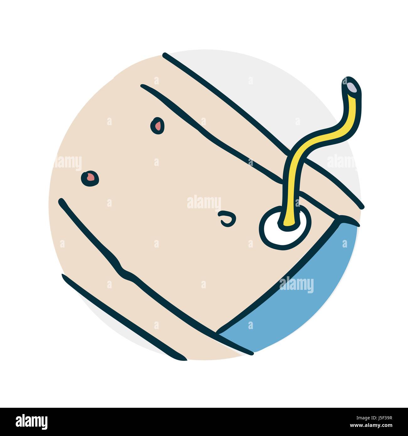 Procédure médicale spéciale sur l'intestin Illustration de Vecteur