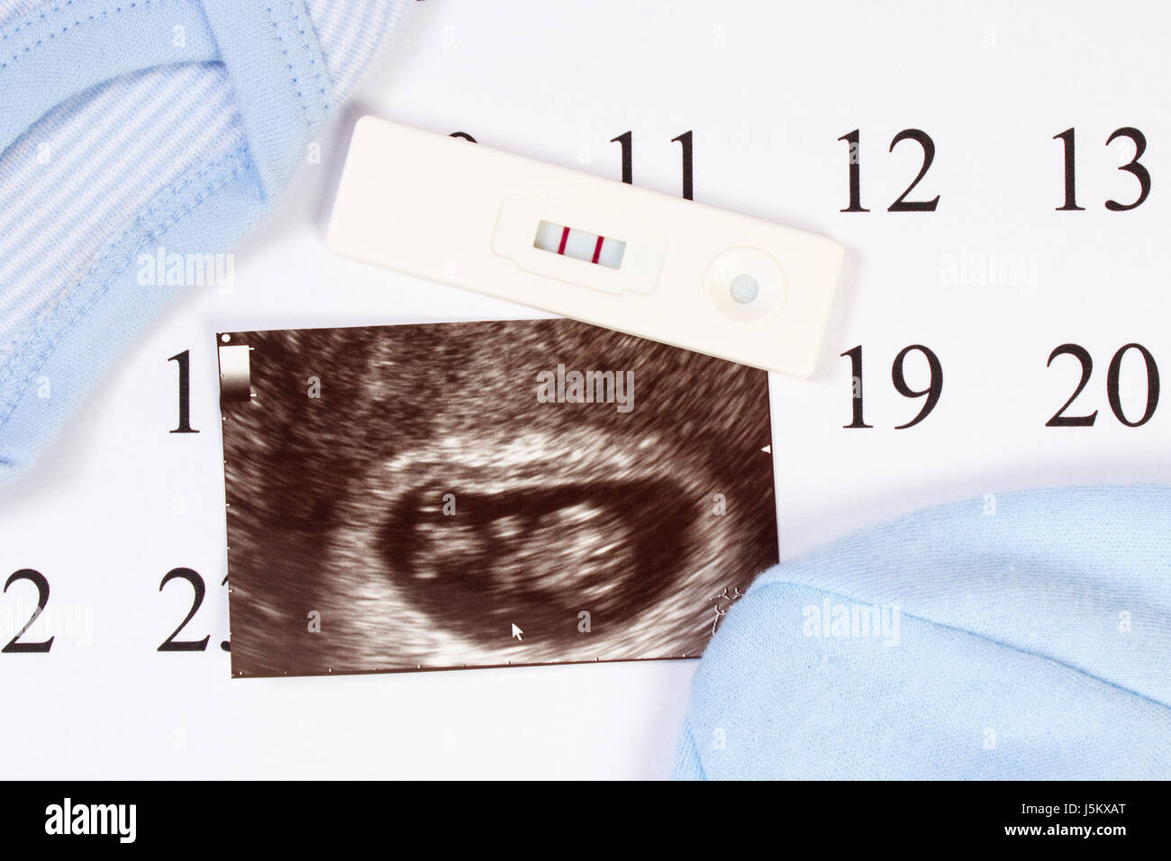 Test de grossesse avec résultat positif, l'échographie de bébé et des vêtements pour nouveau-nés sur le calendrier, concept de l'extension de la famille et s'attendant pour bébé Banque D'Images