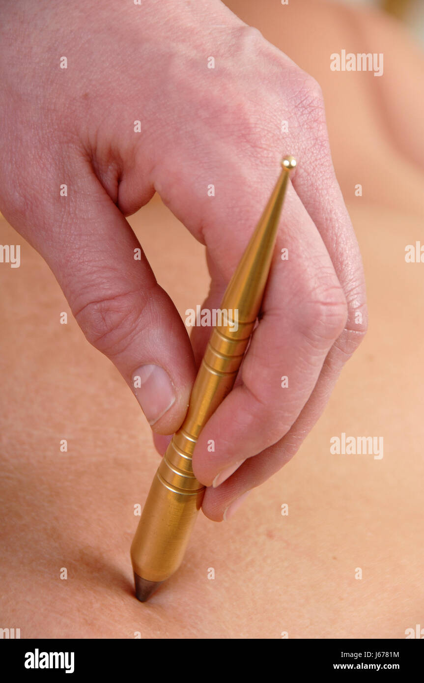 Thérapie alternative acupuncture femme femmes d'activation fourniture caisse-maladie Banque D'Images