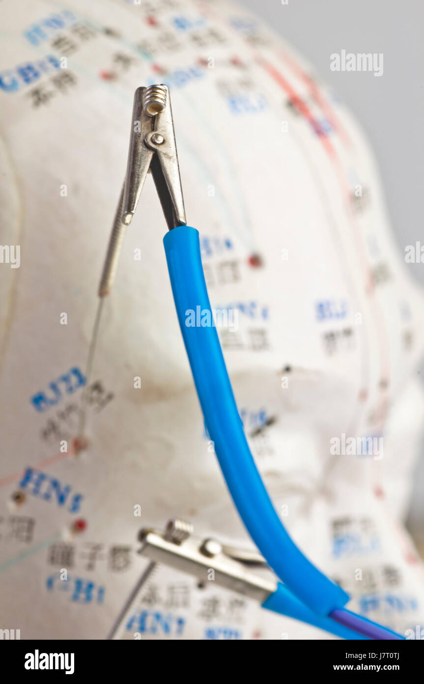 Appareil D'électro-acupuncture Apaisante Biopiezo Deoditoo - Usage Domicile - Neuf - Soulagement Des Douleurs