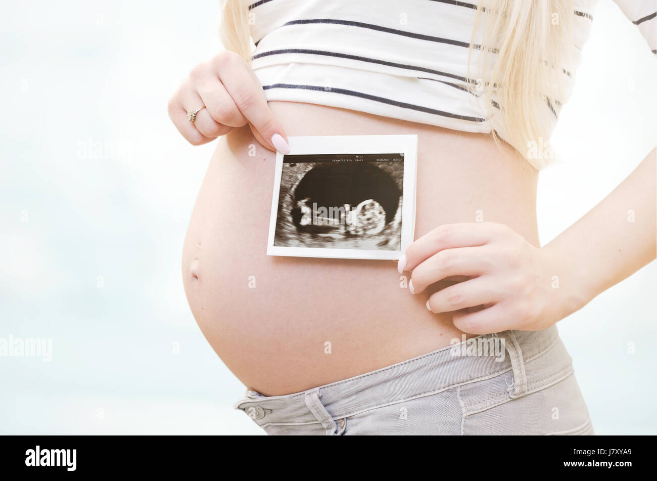 Pregnant woman holding ultrasound scan sur son ventre. femme enceinte bébé échographie nouveau concept grossesse fertilité numérisation Banque D'Images