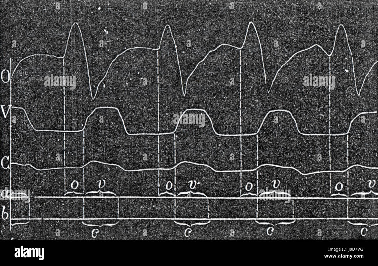 Marey Intrakardial Banque D'Images