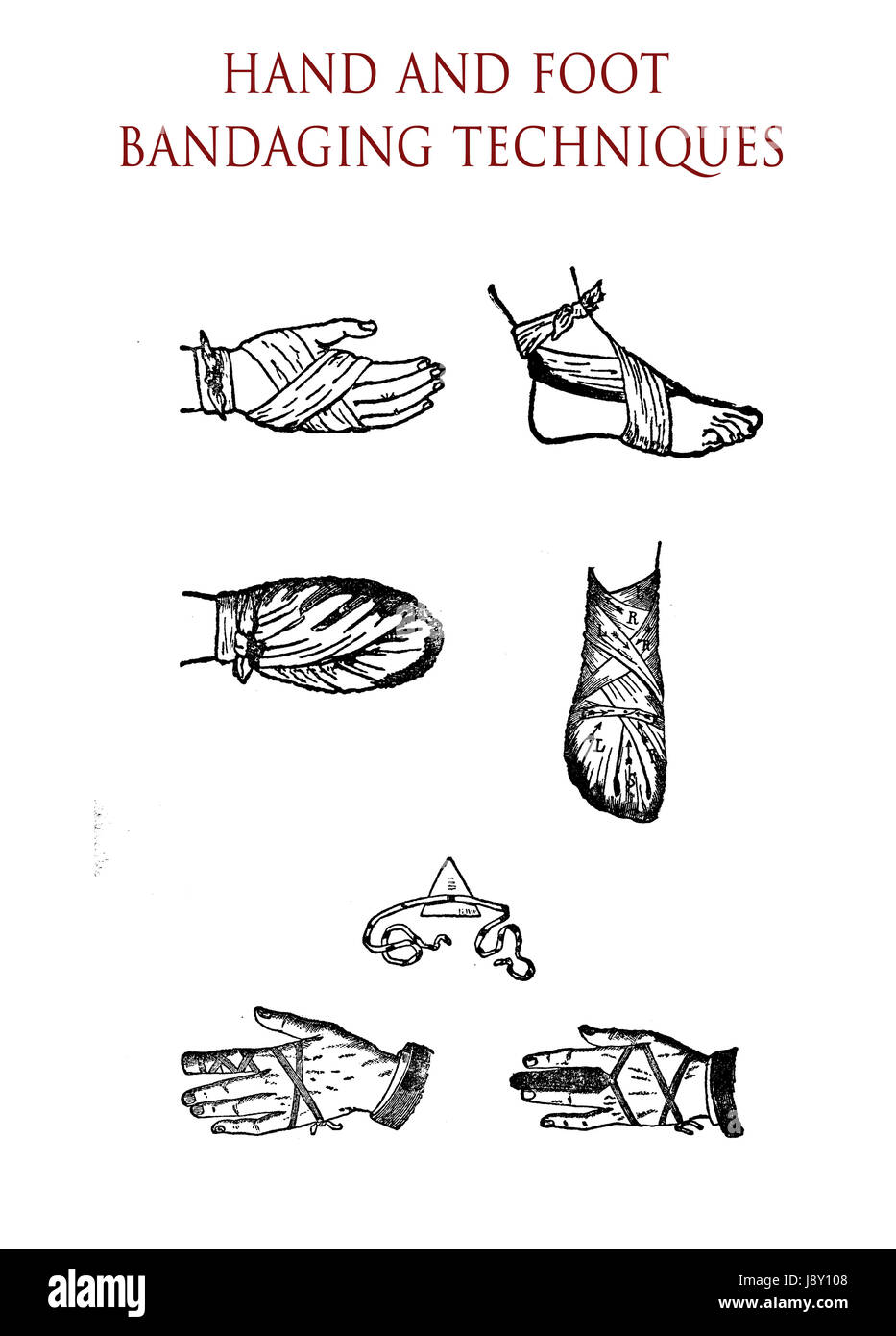 Les techniques de bandage des mains et des pieds Photo Stock - Alamy