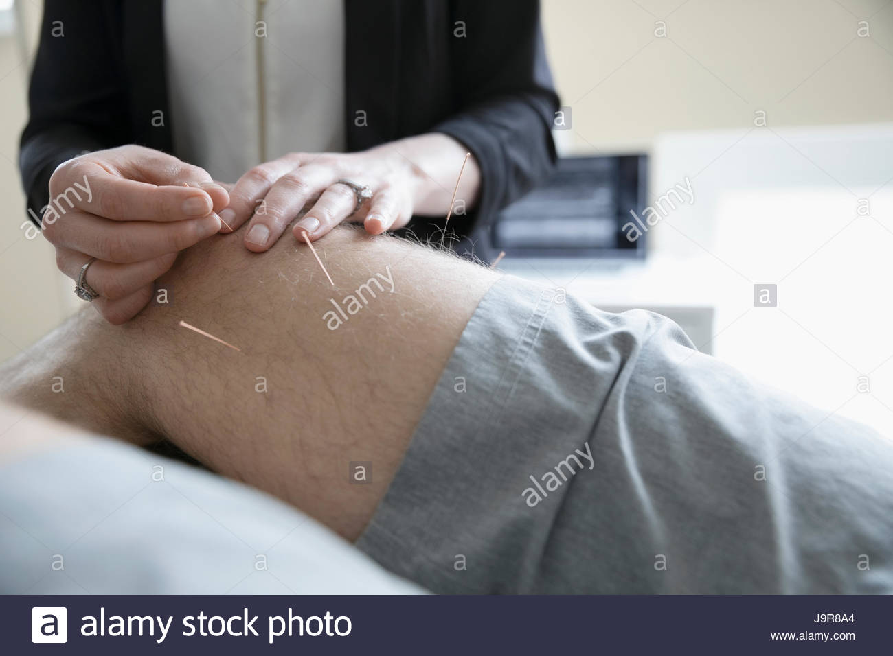 L'insertion d'aiguilles dans acupuncteur femelle de l'homme au genou sur table d'examen clinique Banque D'Images
