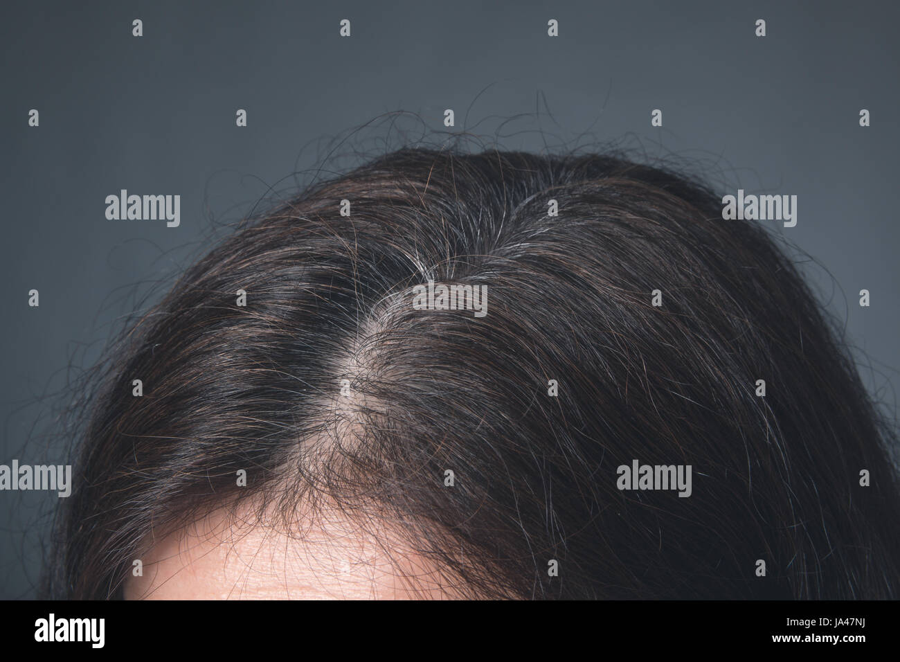 Racine de cheveux Banque de photographies et d’images à haute résolution Alamy