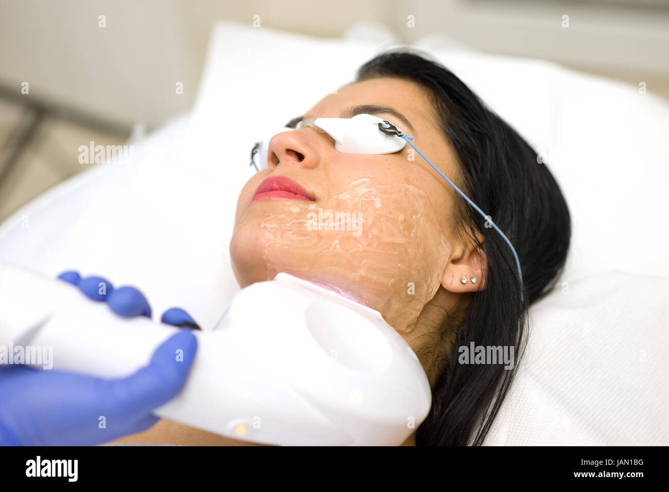 Belle jeune femme allongée sur une table avec des lunettes de protection sur les yeux l'obtention d'un traitement au laser Banque D'Images