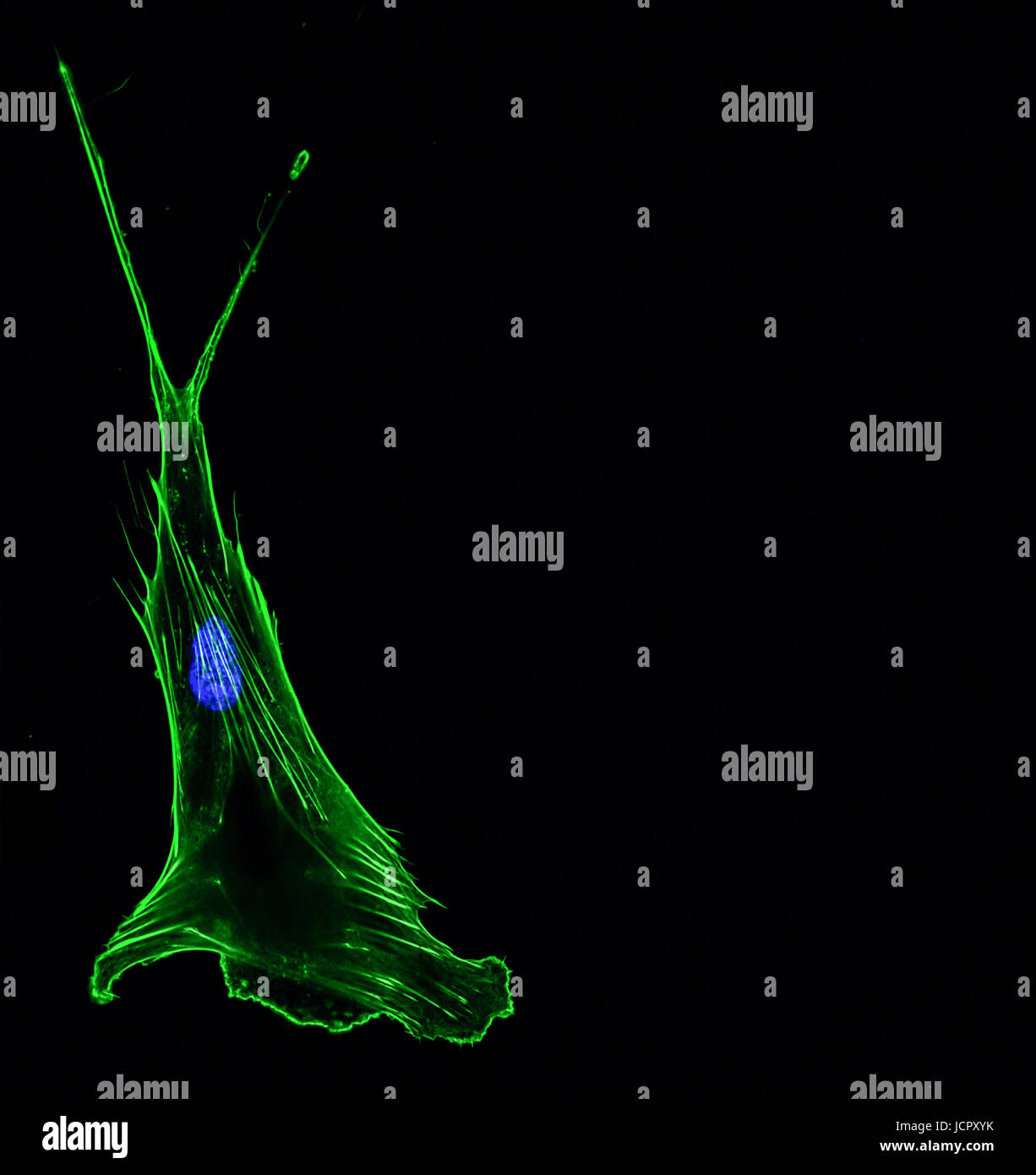 L'imagerie confocale immunofluorescence d'une seule cellule avec cancer du poumon envahissantes cytosquelette dans green et le noyau en bleu Banque D'Images