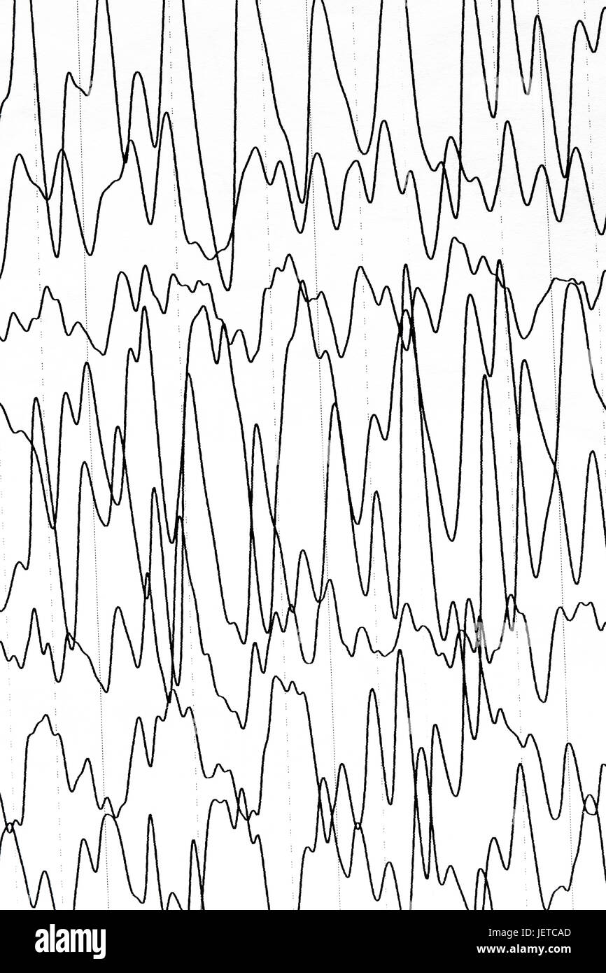 Test de l'électroencéphalographie qui montre l'activité électrique du cerveau avec des troubles neurologiques caractérisé par des crises épileptiques. Banque D'Images
