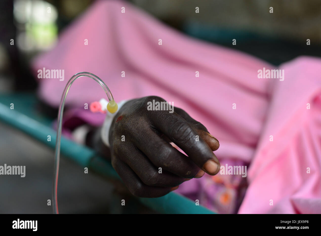 28 juin 2017 - Juba, Soudan du Sud - Jubek, Joyce Auma, 20 chambres, repose sur la restauration à partir d'un grave cas de choléra Le mercredi à l'Hôpital général de Juba, Soudan du Sud, où plus de la moitié de la population souffre d'une grave crise humanitaire dont la famine. (Crédit Image : © Miguel Juarez Lugo via Zuma sur le fil) Banque D'Images