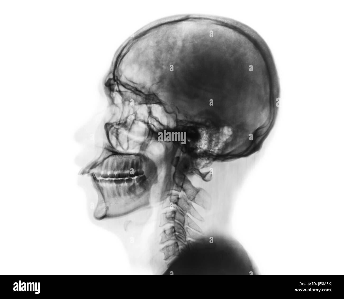 X-ray crâne normal et rachis cervical . Vue latérale . Style couleur Inverser . Banque D'Images