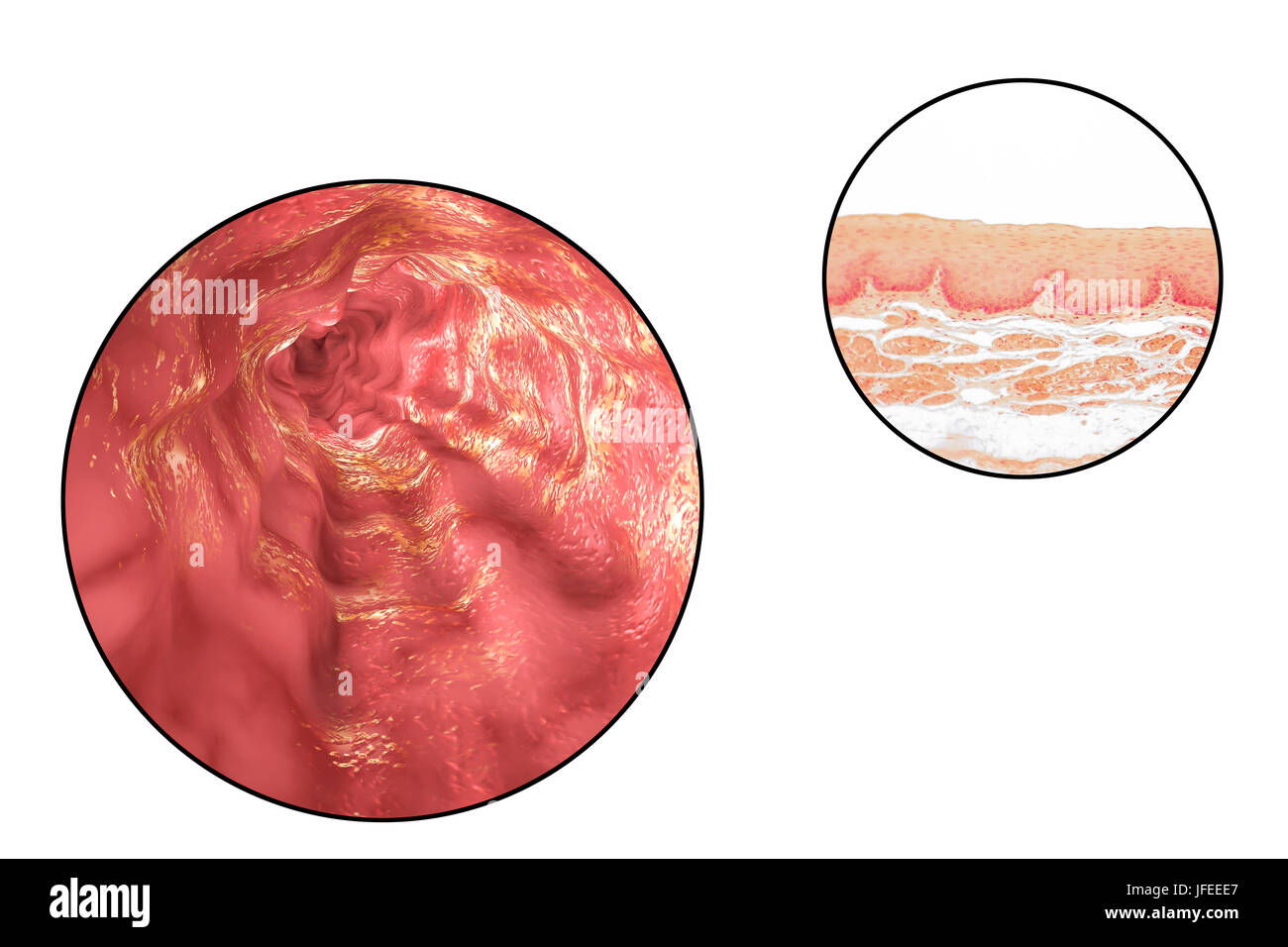 La paroi de l'œsophage. Microphotographie lumière d'une section à travers l'œsophage humain, qui passe les aliments de la bouche à l'estomac. L'oesophage lumen (blanc, haut) est bordée par une couche épaisse d'épithélium pavimenteux stratifié (rouge) qui protège les tissus sous-jacents. En dessous c'est une couche de support de tissu conjonctif, la lamina propria, qui contient des vaisseaux sanguins et est riche en fibres d'élastine. Banque D'Images