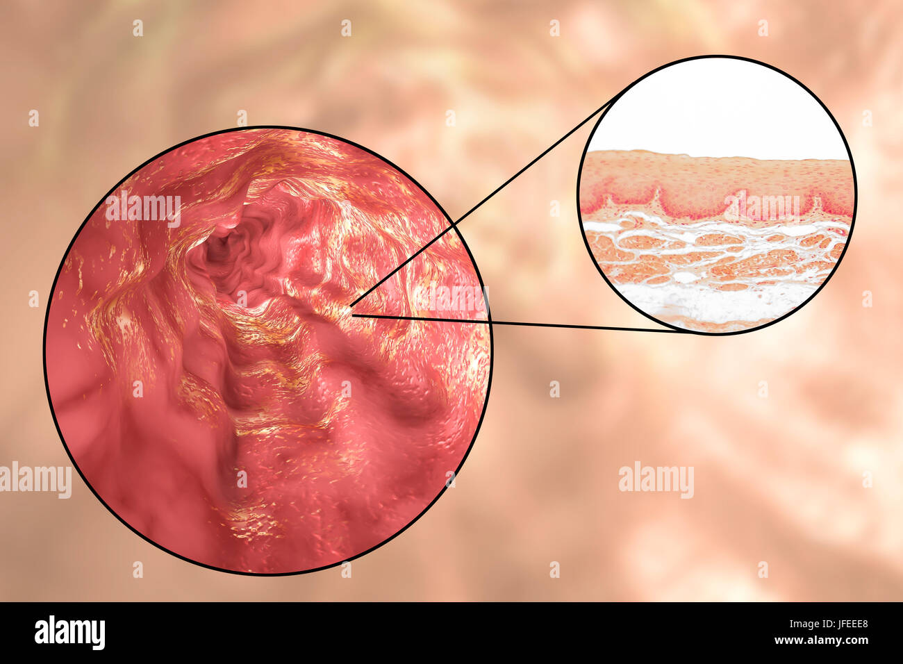 La paroi de l'œsophage. Microphotographie lumière d'une section à travers l'œsophage humain, qui passe les aliments de la bouche à l'estomac. L'oesophage lumen (blanc, haut) est bordée par une couche épaisse d'épithélium pavimenteux stratifié (rouge) qui protège les tissus sous-jacents. En dessous c'est une couche de support de tissu conjonctif, la lamina propria, qui contient des vaisseaux sanguins et est riche en fibres d'élastine. Banque D'Images