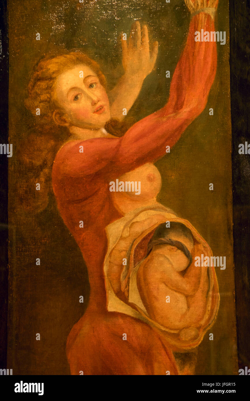 L'Angleterre, Londres, The Wellcome Collection, peinture d'une femme enceinte disséqués par Jacques-Fabien Gautier d'Agoty 1764 Banque D'Images