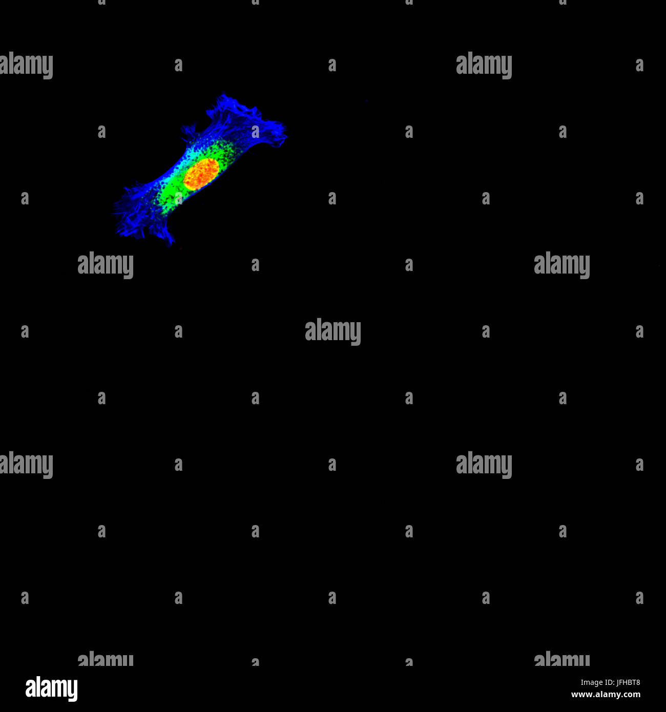 L'immunofluorescence des cellules tumorales humaines avec noyau en rouge et du cytosquelette en bleu Banque D'Images