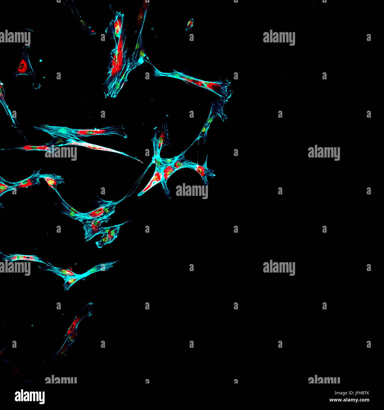 L'immunofluorescence de multiples tumeurs des cellules métastatiques dans la culture de tissus de plus en plus à des fins de recherche Banque D'Images
