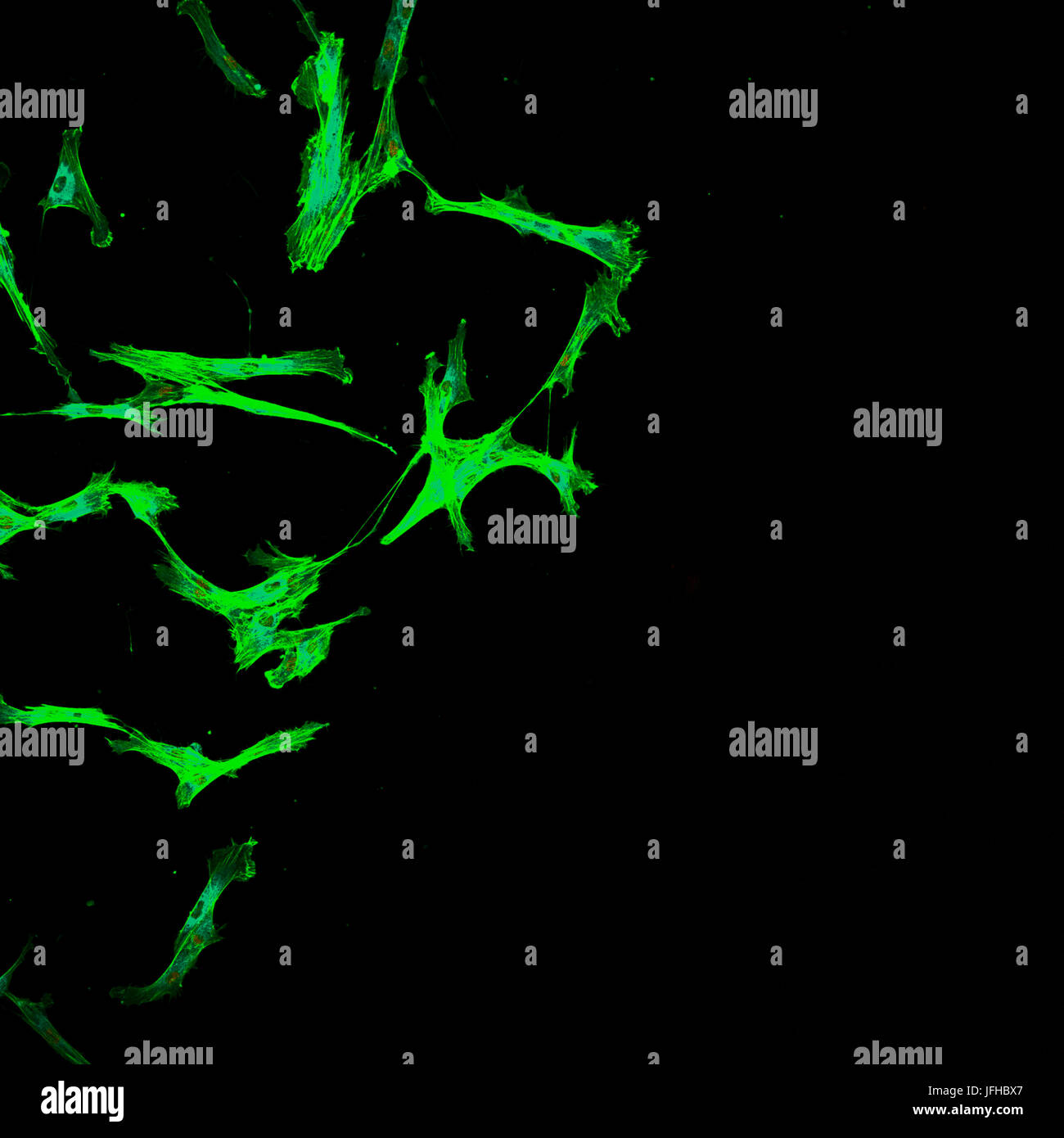 L'immunofluorescence de multiples tumeurs des cellules métastatiques dans la culture de tissus de plus en plus à des fins de recherche Banque D'Images