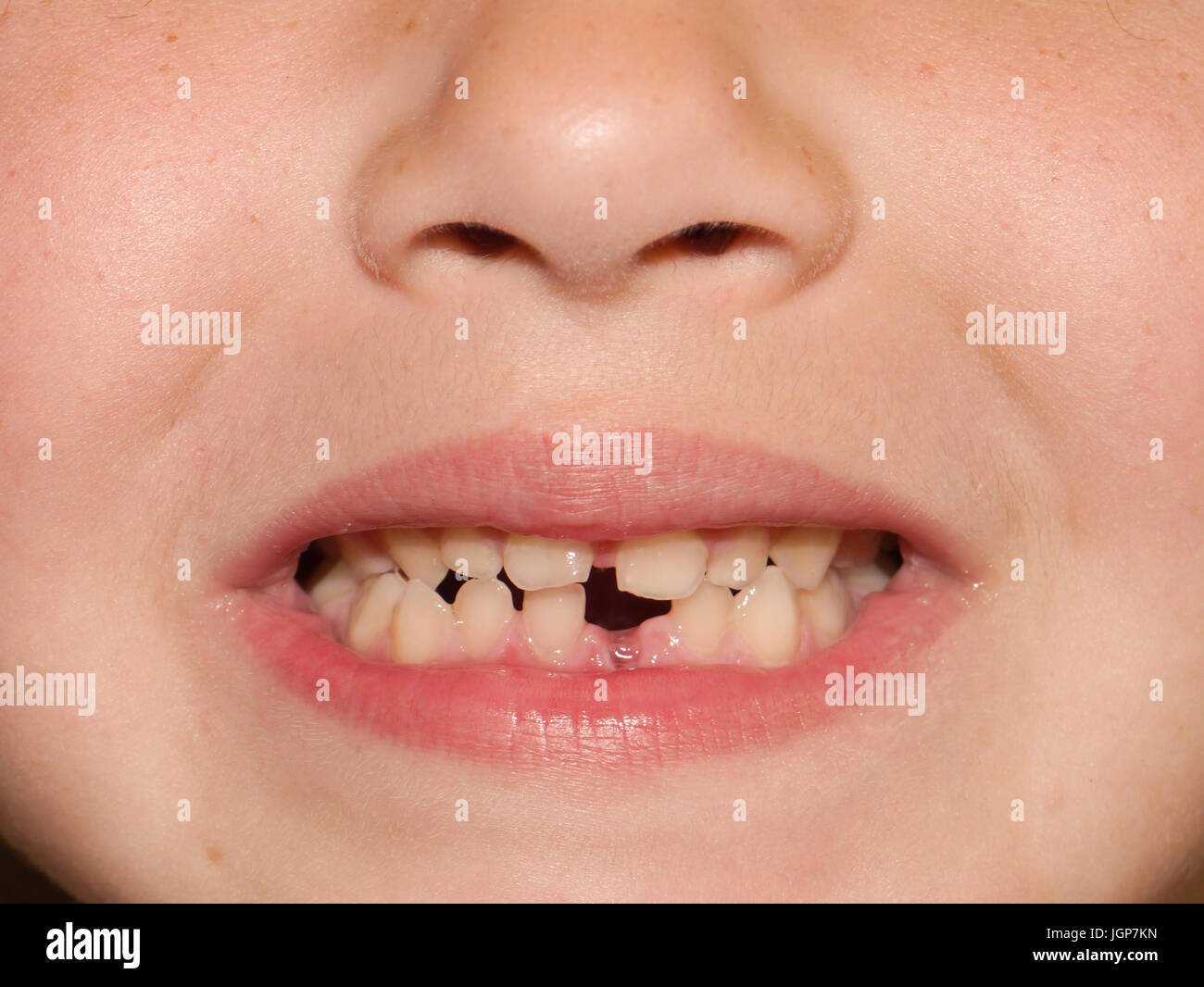Un de près de l'espèce d'un jeune enfant avec des dents manquantes Banque D'Images