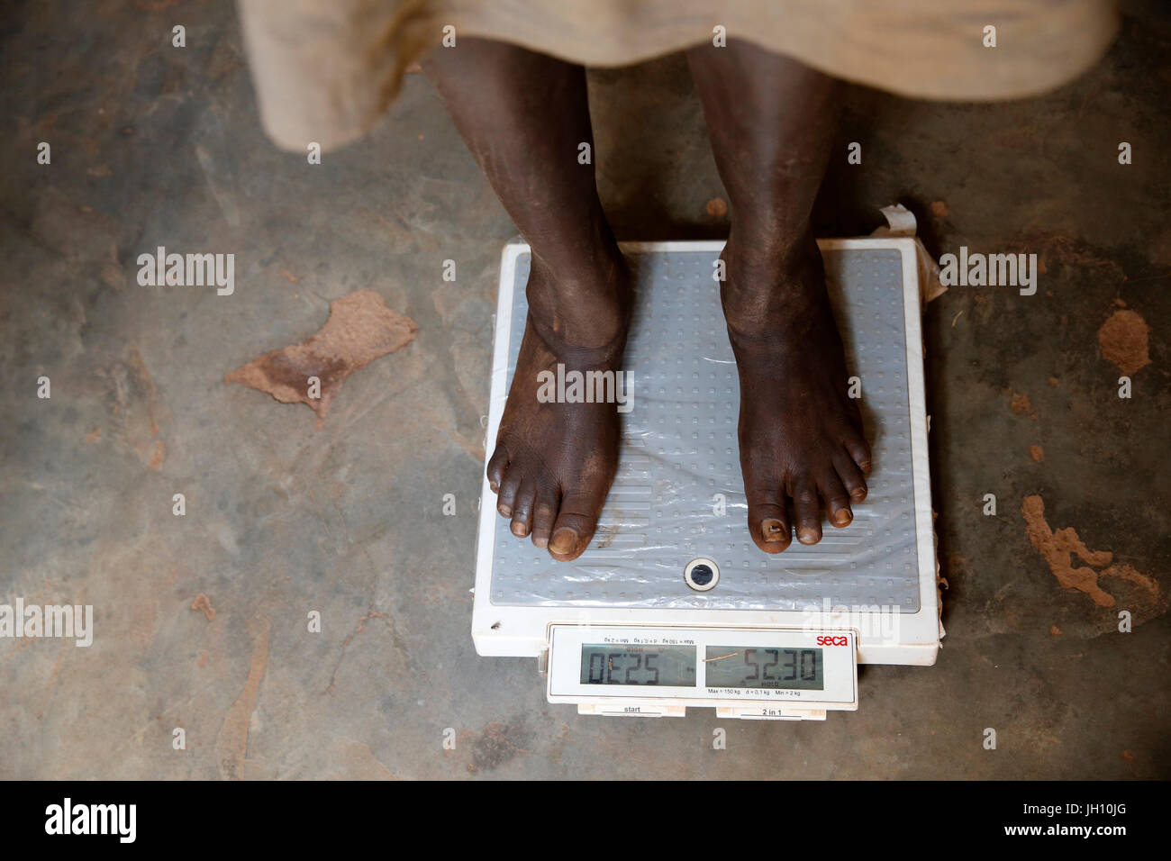 Kiryangondo camp de réfugiés. Le programme de prévention de la malnutrition dirigé par préoccupation dans le monde entier. L'Ouganda. Banque D'Images