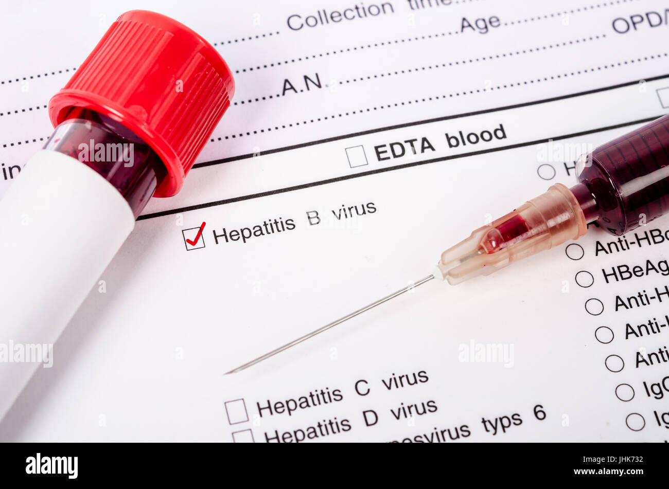 Échantillon de sang pour l'hépatite B (VHB) testingl formulaire de demande  de test de dépistage Photo Stock - Alamy