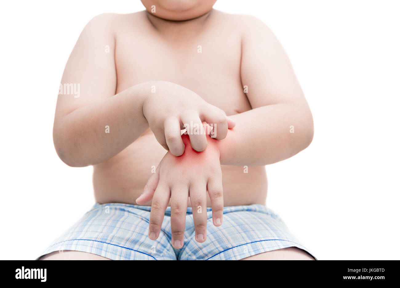 Fat boy obèses rayer la main avec démangeaisons démangeaisons. isolé sur fond blanc, concept avec Santé et médecine Banque D'Images