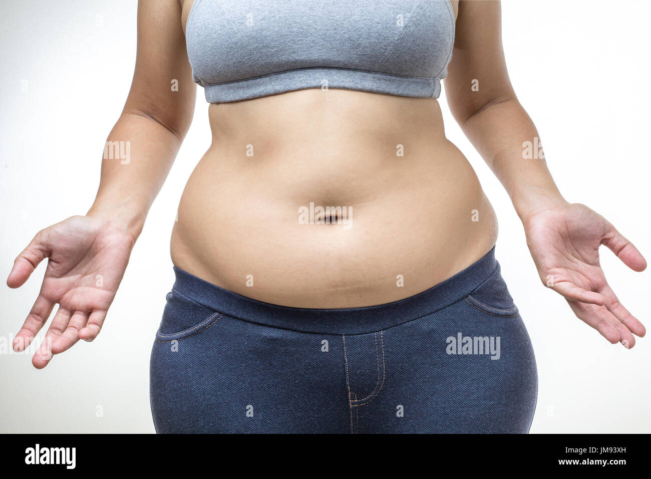 L'excès de femme avec gros ventre Photo Stock - Alamy