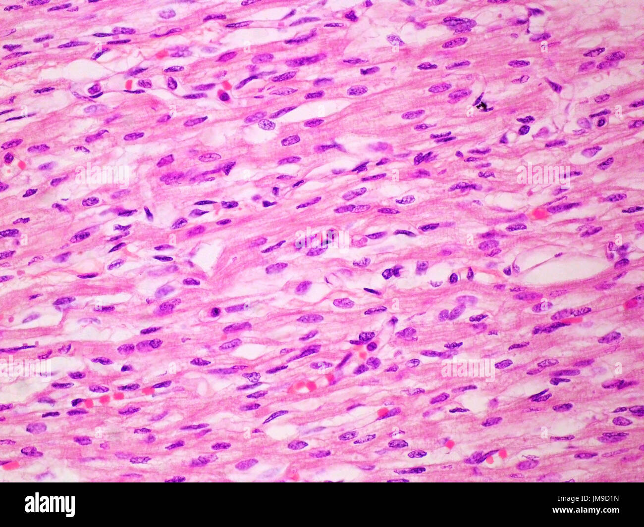 Stries du muscle cardiaque Vue à 400x de grossissement avec coloration à l'éosine et Haemotoxylin. Banque D'Images