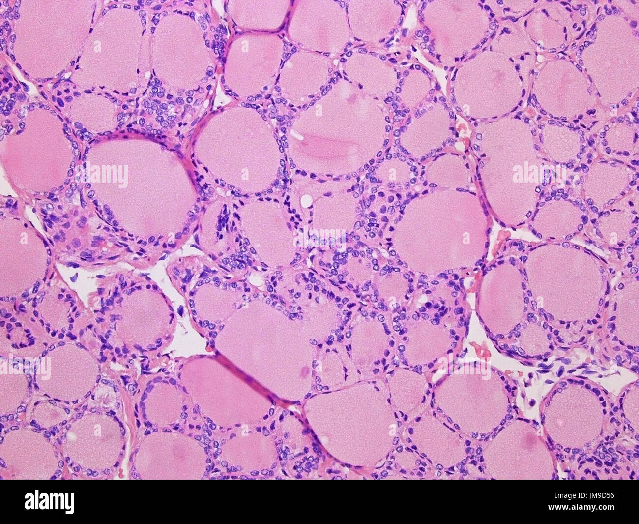 Colloïde de la glande thyroïde à l'200x grossissement avec Haemotoxylin la coloration et l'éosine. Banque D'Images