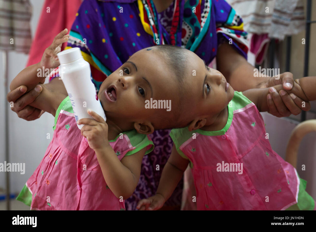 Dhaka, Bangladesh. 29 juillet, 2017. DHAKA, BANGLADESH - 29 juillet : lits jumeaux siamois filles Rabeya l'Islam et l'Islam Rokeya jouer dans un hôpital à Dhaka, Bangladesh, le 29 juillet 2017. Taslima Khatun, professeur d'école, a donné une naissance de jumeaux siamois le dirigé le 16 juillet 2016 après une césarienne. Les jumeaux ont été admis à un hôpital du gouvernement pour examen avant la chirurgie potentiellement à séparer leurs têtes. Zakir Hossain Chowdhury Crédit : zakir/Alamy Live News Banque D'Images
