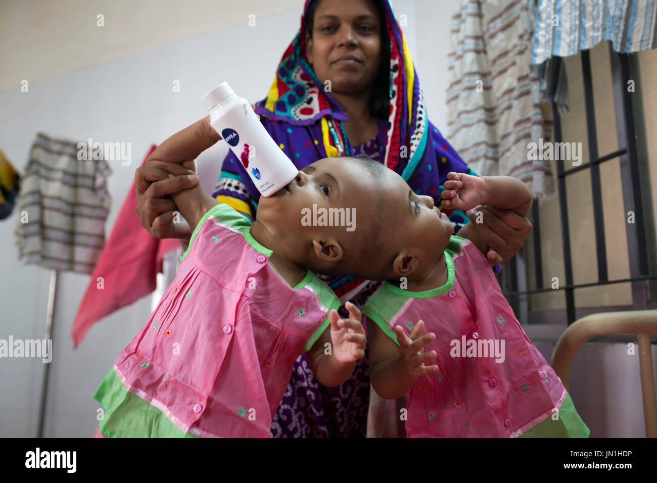 Dhaka, Bangladesh. 29 juillet, 2017. DHAKA, BANGLADESH - 29 juillet : lits jumeaux siamois filles Rabeya l'Islam et l'Islam Rokeya jouer dans un hôpital à Dhaka, Bangladesh, le 29 juillet 2017. Taslima Khatun, professeur d'école, a donné une naissance de jumeaux siamois le dirigé le 16 juillet 2016 après une césarienne. Les jumeaux ont été admis à un hôpital du gouvernement pour examen avant la chirurgie potentiellement à séparer leurs têtes. Zakir Hossain Chowdhury Crédit : zakir/Alamy Live News Banque D'Images