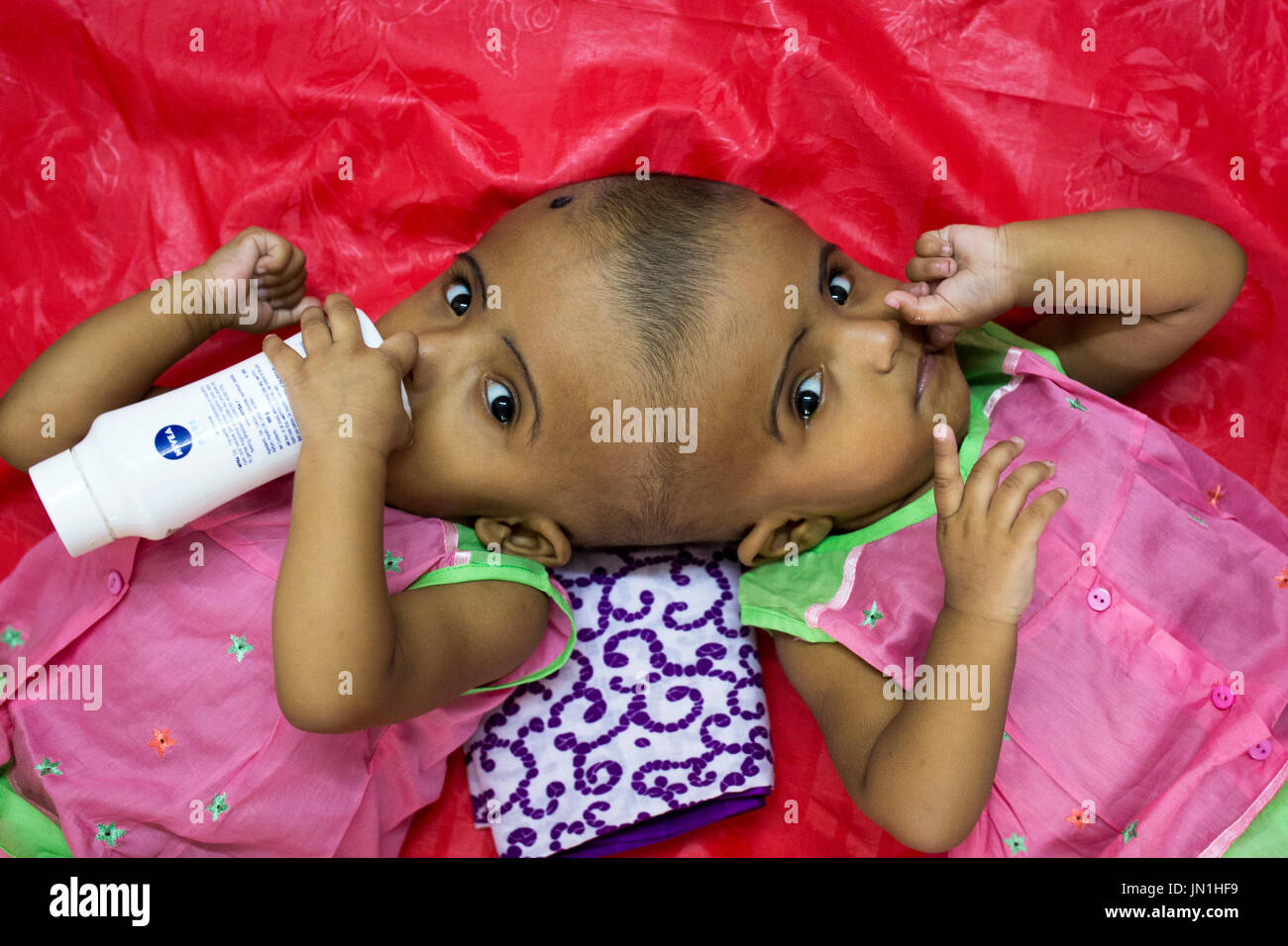 Dhaka, Bangladesh. 29 juillet, 2017. DHAKA, BANGLADESH - 29 juillet : lits jumeaux siamois filles Rabeya l'Islam et l'Islam Rokeya jouer dans un hôpital à Dhaka, Bangladesh, le 29 juillet 2017. Taslima Khatun, professeur d'école, a donné une naissance de jumeaux siamois le dirigé le 16 juillet 2016 après une césarienne. Les jumeaux ont été admis à un hôpital du gouvernement pour examen avant la chirurgie potentiellement à séparer leurs têtes. Zakir Hossain Chowdhury Crédit : zakir/Alamy Live News Banque D'Images