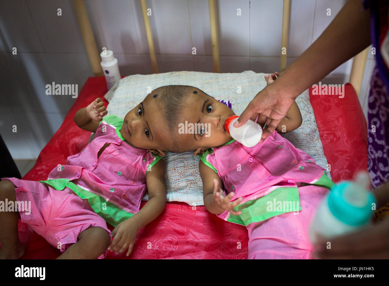 Dhaka, Bangladesh. 29 juillet, 2017. DHAKA, BANGLADESH - 29 juillet : lits jumeaux siamois filles Rabeya l'Islam et l'Islam Rokeya boire du lait dans un hôpital à Dhaka, Bangladesh, le 29 juillet 2017. Taslima Khatun, professeur d'école, a donné une naissance de jumeaux siamois le dirigé le 16 juillet 2016 après une césarienne. Les jumeaux ont été admis à un hôpital du gouvernement pour examen avant la chirurgie potentiellement à séparer leurs têtes. Zakir Hossain Chowdhury Crédit : zakir/Alamy Live News Banque D'Images