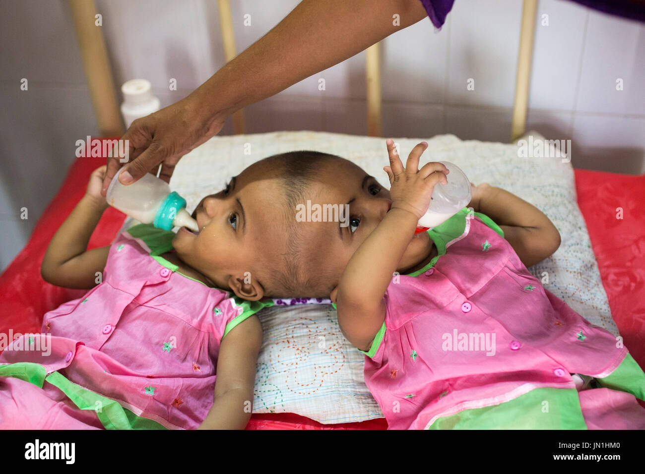 Dhaka, Bangladesh. 29 juillet, 2017. DHAKA, BANGLADESH - 29 juillet : lits jumeaux siamois filles Rabeya l'Islam et l'Islam Rokeya boire du lait dans un hôpital à Dhaka, Bangladesh, le 29 juillet 2017. Taslima Khatun, professeur d'école, a donné une naissance de jumeaux siamois le dirigé le 16 juillet 2016 après une césarienne. Les jumeaux ont été admis à un hôpital du gouvernement pour examen avant la chirurgie potentiellement à séparer leurs têtes. Zakir Hossain Chowdhury Crédit : zakir/Alamy Live News Banque D'Images